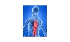 Meagan - Model DISCSS - Dynamic Interferential Spinal Cord Stimulation System