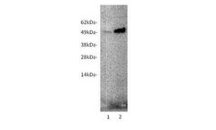 Ampersand - Model ANGPTL7 -mAb (ANG7-1G8) M2018 - Human Antibodie