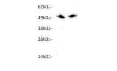 Ampersand - Model ANGPTL7 - mAb (ANG7-2H6) M2017 - Human Antibodie
