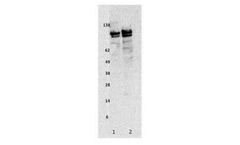 Ampersand - Model R3006 - Ceruloplasmin Human, pAb ( aff pur) Antibodie