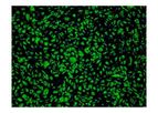 ScienCell - Model 6000 - Human Cardiac Microvascular Endothelial Cells