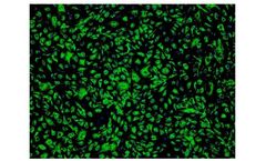 ScienCell - Model 6000 - Human Cardiac Microvascular Endothelial Cells