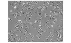 ScienCell - Model 3610 - Human Adrenal Cortical Cells
