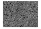 ScienCell - Model 1000 - Human Brain Microvascular Endothelial Cells