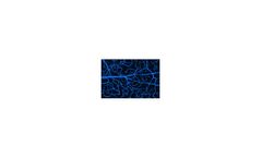Model MET-5123 - Alanine Aminotransferase (ALT) Activity Assay Kit (Colorimetric)