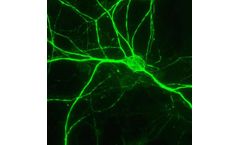 Aves - Anti-NFH (Neurofilament Heavy Chain) Antibody