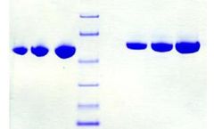 Athens - Model 16-16-012020 - Antithrombin III, Human Plasma