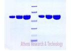 Athens - Model 16-16-011609 - Alpha 1 Antitrypsin, Human Plasma