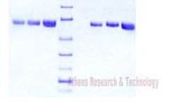 Athens - Model 16-16-012901 - Alpha 2 Antiplasmin, Human Plasma