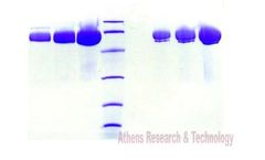 Athens - Model 16-16-012400 - Alpha 1 Antichymotrypsin, Human Plasma