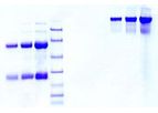 Athens - Model 16-16-090701 - Immunoglobulin A (IgA), Normal Human Plasma