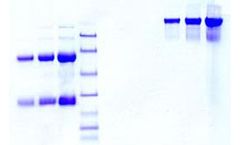 Athens - Model 16-16-090701 - Immunoglobulin A (IgA), Normal Human Plasma