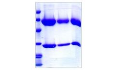 Athens - Model 16-16-090701-1M - Immunoglobulin A1 (IgA1), Human Myeloma Plasma