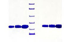 Athens - Model 16-16-120101 - Apolipoprotein AI, Human Plasma