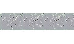Upcyte - Liver Sinusoidal Endothelial Cells