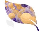 IBIO - Model 101 - Immuno Oncology Therapeutics