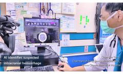 DeepCT AI ICH System Applied in Hospital - Video