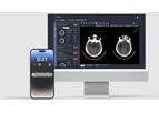 Deep01 - Version DeepCT - Identifies Intracranial Hemorrhage (ICH) Software