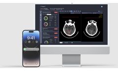 Deep01 - Version DeepCT - Identifies Intracranial Hemorrhage (ICH) Software