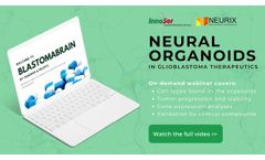BlastomaBrain Webinar On Demand - Trailer - Video