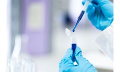 Inovarion - Cancer Diagnostic Biomarkers