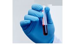 AlphaLiquid - Model Detect - Tumor-Informed, Hybrid-Capture NGS-Based Liquid Biopsy Test