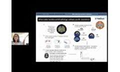 White Matter Microstructure and Alzheimer’s Disease Pathology Insights from Tractography and PET - Video