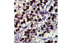 Super Sensitive - Model QD551-GPEN - Polymer HRP IHC Detection for NanoVIP