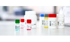 SERION - Model ELISA Classic / Antigen - Diagnostic for Quantitative Immunoassays for the Detection of Human Antibodies