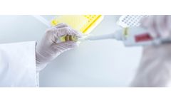 SERION - Complement Fixation Test (CFT) Reagents for Complement Fixation Tests