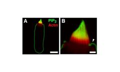 Model Z-A045 - Anti-PtdIns (4,5) P2 IgM In Ascites