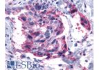 PathPlus - Model LS-A2099 - Polyclonal Rabbit anti-Human LTB4R2 / BLT2 Antibody (Cytoplasmic Domain, IHC)