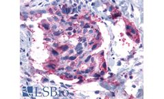 PathPlus - Model LS-A2099 - Polyclonal Rabbit anti-Human LTB4R2 / BLT2 Antibody (Cytoplasmic Domain, IHC)