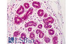 IHC-plus - Model LS-B1373 - Polyclonal Rabbit anti-Human IRS1 Antibody (IHC, IF, WB)