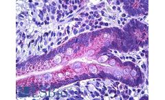 IHC-plus - Model LS-B5747 - Polyclonal Rabbit anti-Human IRS1 Antibody (AA289-338, IHC, IF)