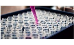 T-cell Proliferation & Cytokine Analysis