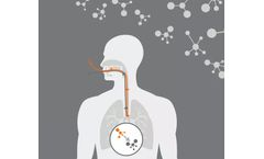 Owlstone Medical - Exogenous Volatile Organic Compound (EVOC) Probes