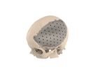 Amplify - Model CMF - Craniomaxillofacial Devices
