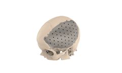 Amplify - Model CMF - Craniomaxillofacial Devices