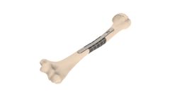 Amplify - Limb Saving Alternatives Device