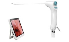 Geyi - Single-use Digital Flexible Hysteroscope