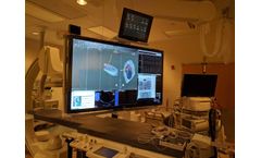 Clarity - Surgical Monitor Shields