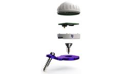 Caira - Navigation System for Knee Replacement