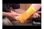 Ankle Stirrup Splint Technique - Video