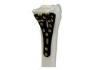 McGinley Orthopedics - Lever Action Plate System