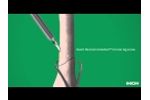 Inion Freedom Drill Tap - Video