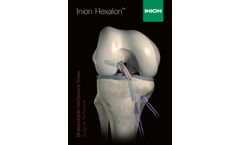 Inion Hexalon Surgical Technique - Brochure