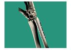 Inion FreedomPlate - Fracture Fixation System