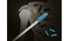 Inion FixOn - Biocomposite Suture Anchor