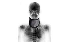 Model TSS - Thyroid Shield Standard